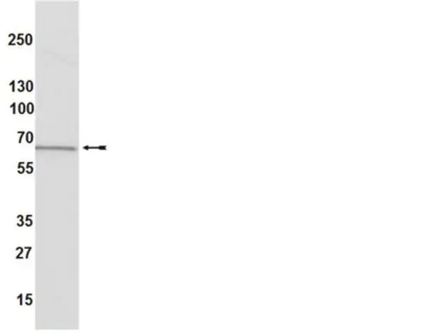 Anti-Estrogen Receptor α Antibody, clone 60C, rabbit monoclonal