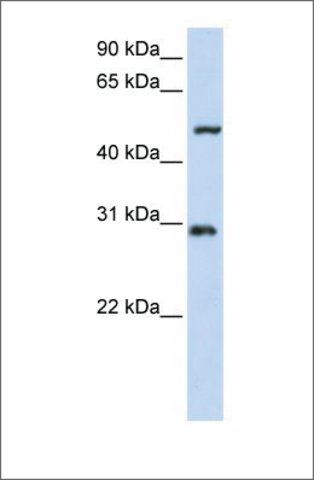 Anti-ZNF138 (ab2) antibody produced in rabbit