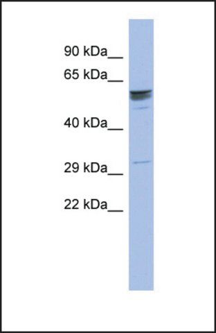 Anti-ZNF146 antibody produced in rabbit