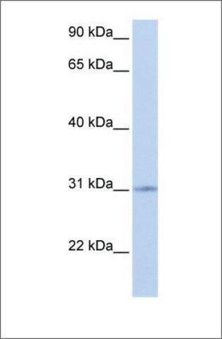 Anti-ZNF146 antibody produced in rabbit