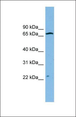 Anti-ZNF135, (N-terminal) antibody produced in rabbit