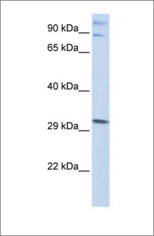 ANTI-ZNF148 antibody produced in rabbit