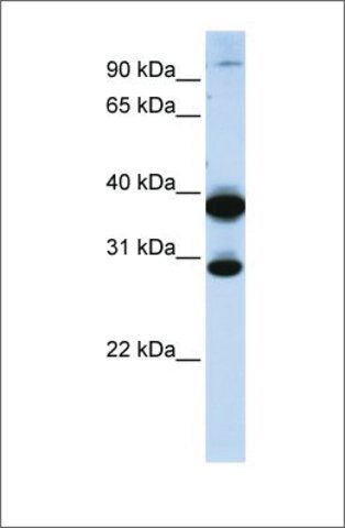 Anti-ZNF138 (ab1) antibody produced in rabbit