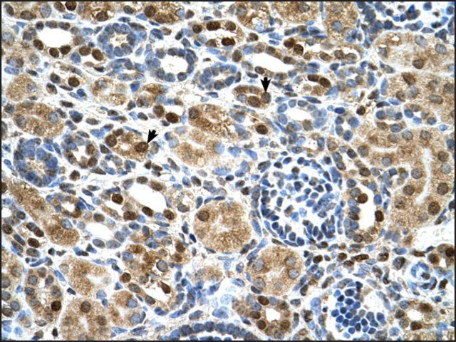 Anti-ZNF169 antibody produced in rabbit