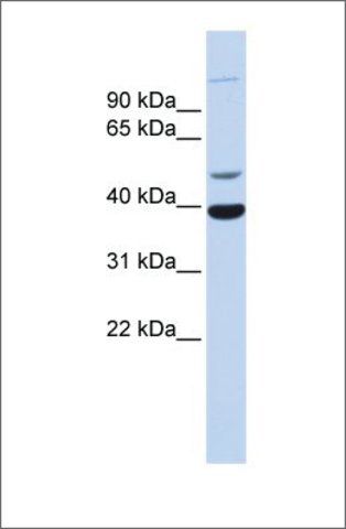 Anti-ZNF124 (ab1) antibody produced in rabbit