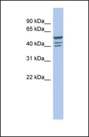 Anti-ZNF140 antibody produced in rabbit