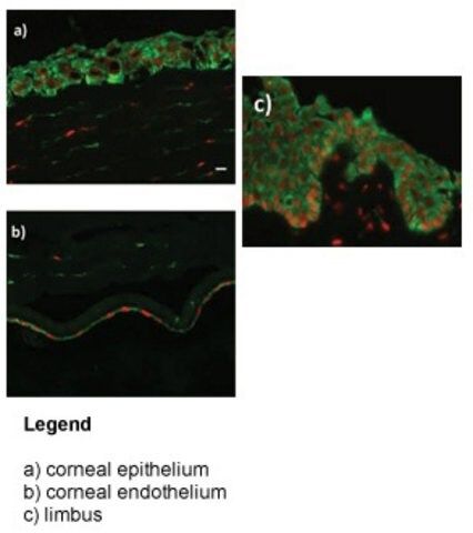 Anti-ZNF133 antibody produced in rabbit