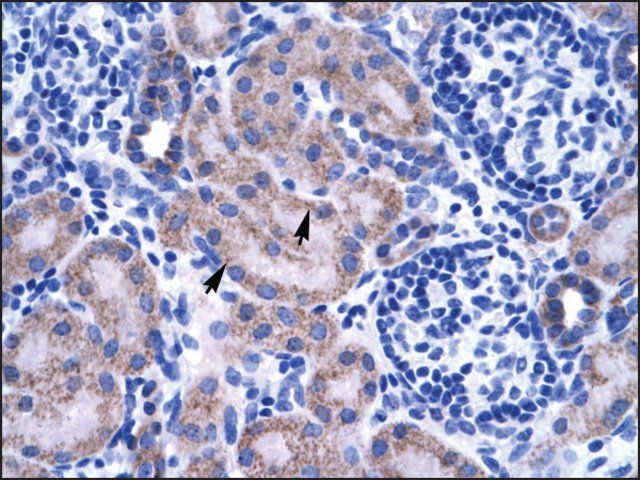 Anti-ZNF134 (AB1) antibody produced in rabbit