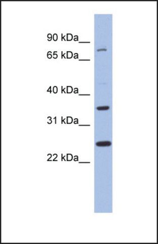 Anti-ZNF133, (N-terminal) antibody produced in rabbit