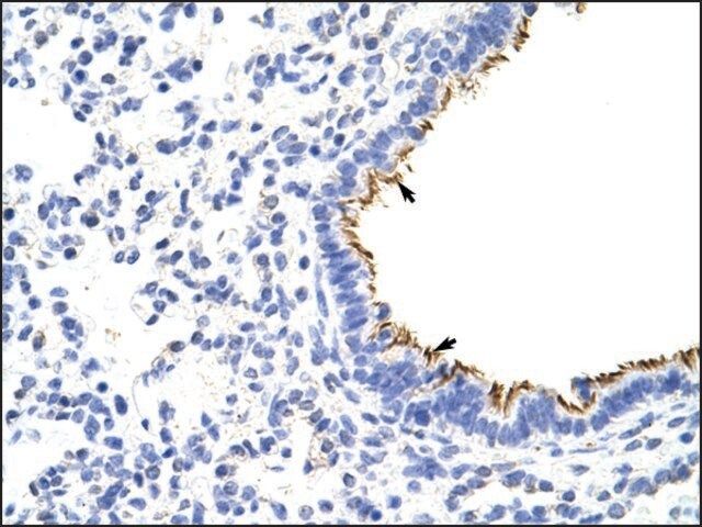 Anti-ZNF16 (AB1) antibody produced in rabbit