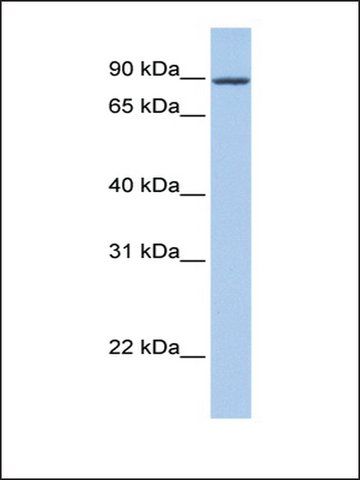 Anti-ZNF16 (AB2) antibody produced in rabbit