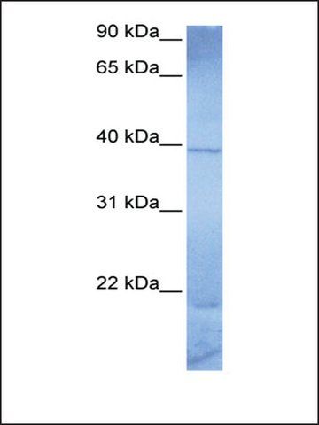 Anti-ZNF121 antibody produced in rabbit