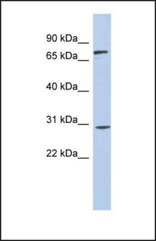 Anti-ZNF131 antibody produced in rabbit