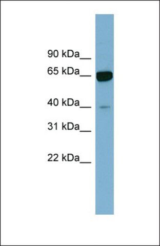Anti-ZNF169, (N-terminal) antibody produced in rabbit