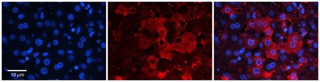 Anti-ZNF142 antibody produced in rabbit