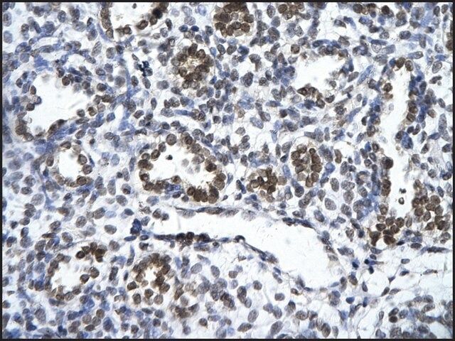ANTI-ZNF148 antibody produced in rabbit