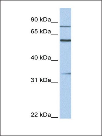 Anti-ZNF16 (AB3) antibody produced in rabbit
