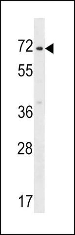 ANTI-ZNF155(C-TERMINAL) antibody produced in rabbit