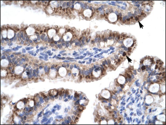 Anti-ZNF167 antibody produced in rabbit