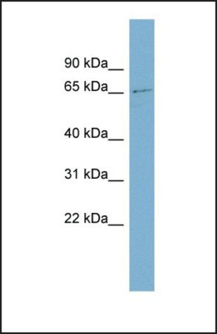 Anti-ZNF18 antibody produced in rabbit