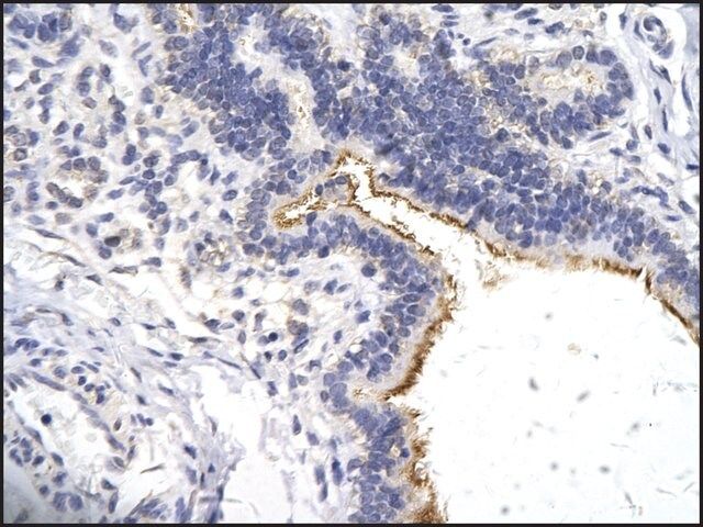 Anti-ZNF180 antibody produced in rabbit