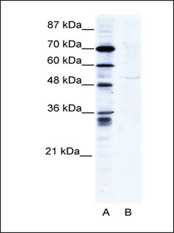 Anti-ZNF134 (AB2) antibody produced in rabbit