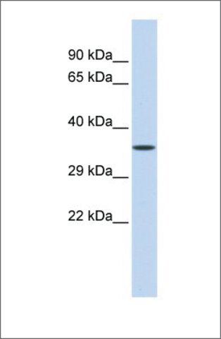 Anti-ZNF124 (ab2) antibody produced in rabbit