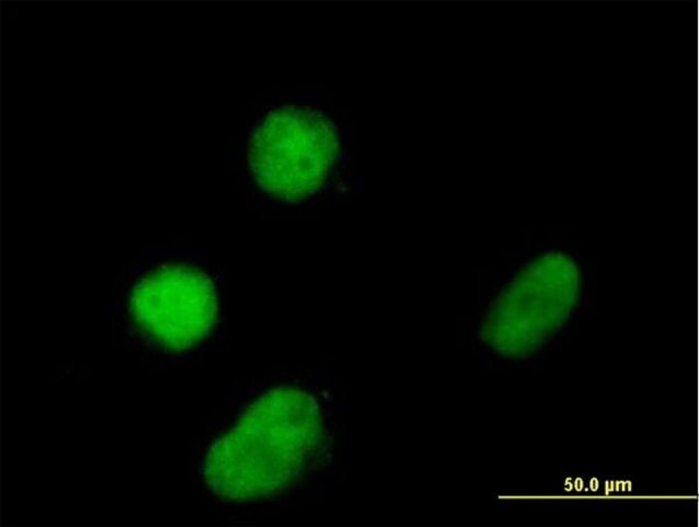 Anti-ZNF131 antibody produced in mouse