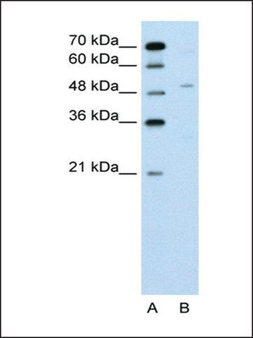 Anti-ZNF19 (AB1) antibody produced in rabbit