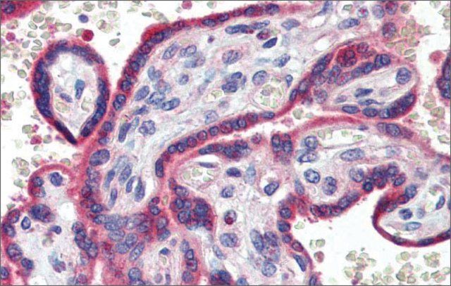 Anti-ZNF165 antibody produced in rabbit