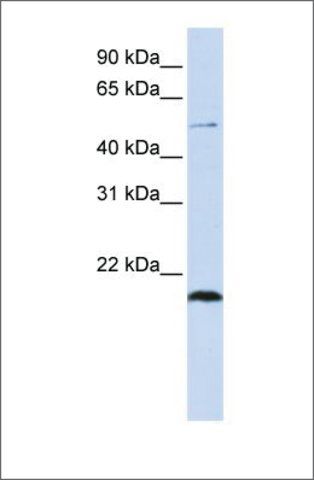 Anti-ZNF683 antibody produced in rabbit