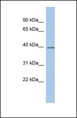 Anti-ZNF670, (N-terminal) antibody produced in rabbit