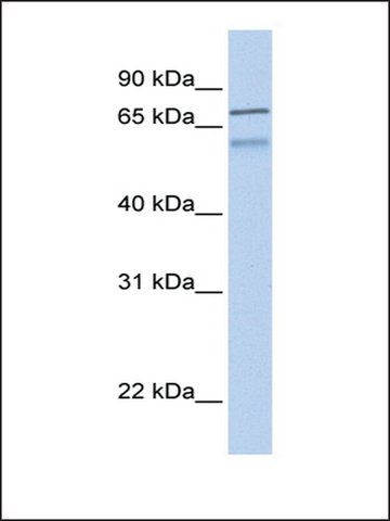 Anti-ZNF671 antibody produced in rabbit