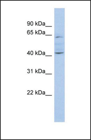 Anti-ZNF674, (N-terminal) antibody produced in rabbit