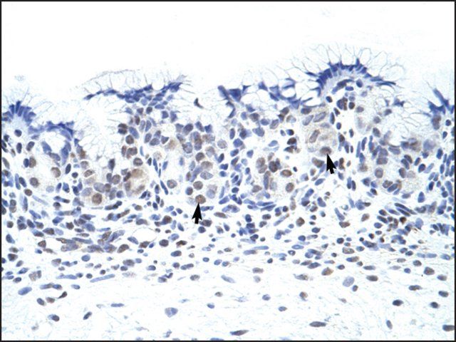 Anti-ZNF70 (AB2) antibody produced in rabbit
