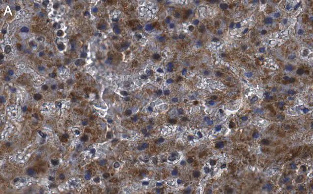Anti-Haptoglobin Antibody, clone 2D22 ZooMAb<sup>®</sup> Rabbit Monoclonal