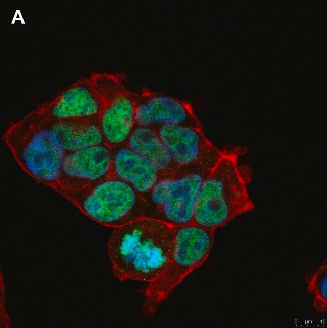 Anti-Histone H3.3 G34R Antibody, clone 2L10 ZooMAb<sup>®</sup> Rabbit Monoclonal