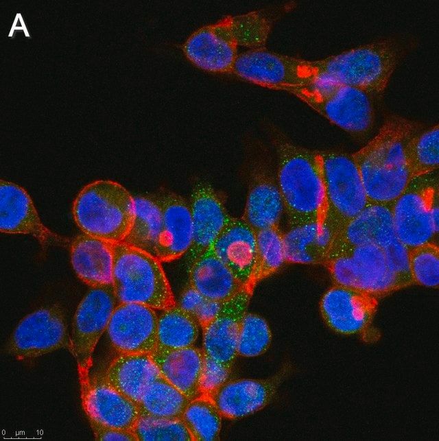 Anti-GPR146 Antibody, clone 1F6 ZooMAb<sup>®</sup> Rabbit Monoclonal