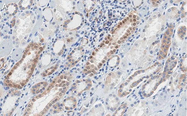 Anti-STAT1 (isoform alpha) Antibody, clone 1D4 ZooMAb<sup>®</sup> Rabbit Monoclonal