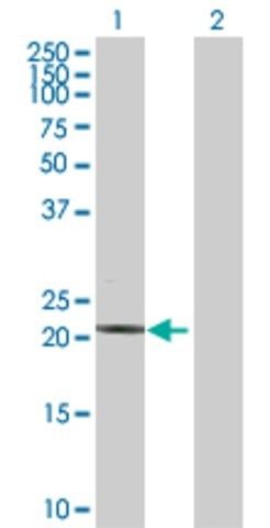 Anti-TNNI2 antibody produced in rabbit