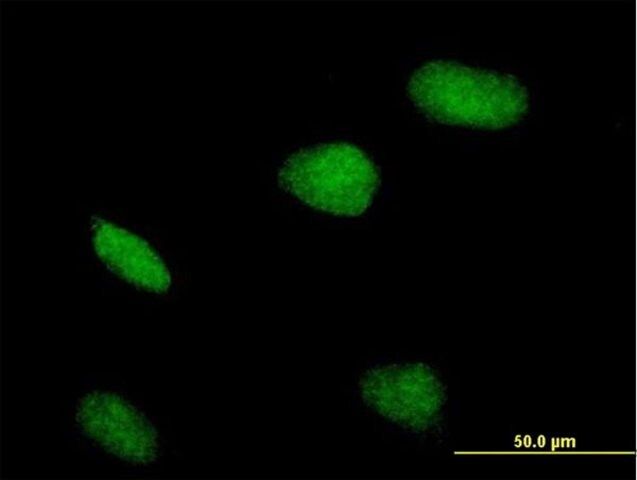 Anti-ZBTB32 antibody produced in mouse