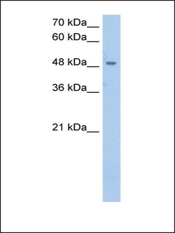 Anti-SSB antibody produced in rabbit
