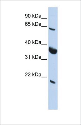 Anti-SRPR (ab2) antibody produced in rabbit