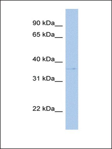 Anti-SULT1C2 antibody produced in rabbit