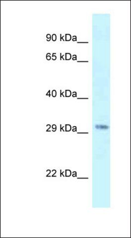 Anti-SUV420H1 antibody produced in rabbit