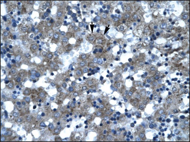 Anti-SUPT3H antibody produced in rabbit