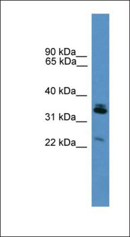 Anti-SYNPR antibody produced in rabbit