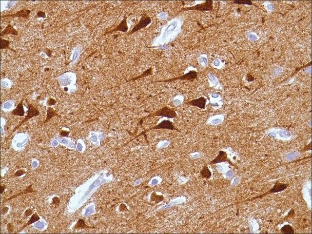 Anti-Syntaxin 1A antibody, Rabbit monoclonal