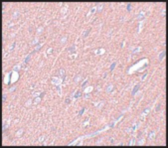 Anti-SYNGR3 antibody produced in rabbit