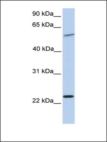 Anti-SYNGR2 antibody produced in rabbit